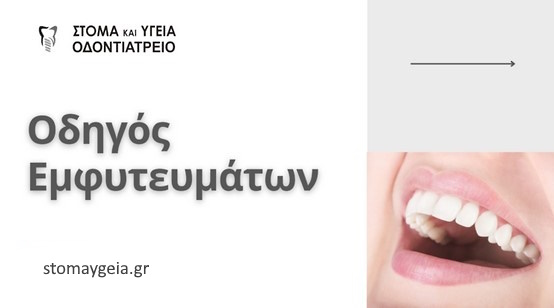 εμφυτευματα δοντιων